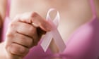 US breast cancer deaths fall but younger women increasingly diagnosed – study