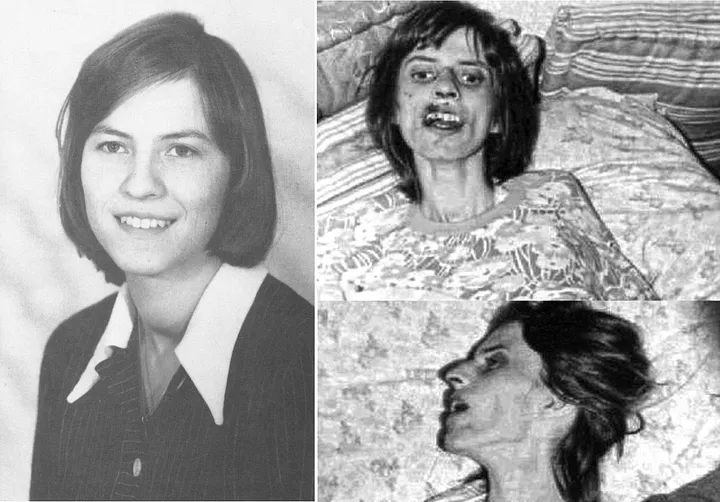 Before and after the exorcism of Anneliese Michel