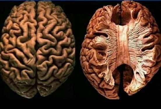 The brain can start eating itself if it doesn’t get enough sleep. Sleep loss can trigger astrocytes to start breaking down more of the brain’s connect…