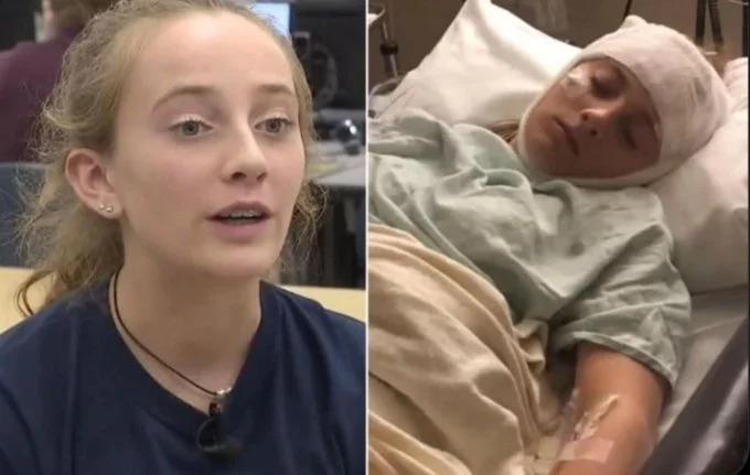 Riley Horner, an Illinois teenager, was accidentally kicked in the head.As a result of the injury, her memory resets every two hours, and she wakes up…