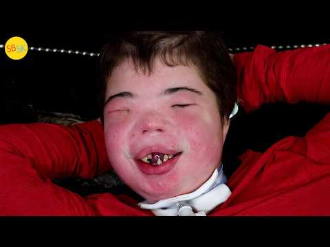 Living with One of the Rarest Conditions Ever (Brody’s Battle)