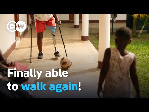 Uganda – Protheses for a new life | DW Documentary