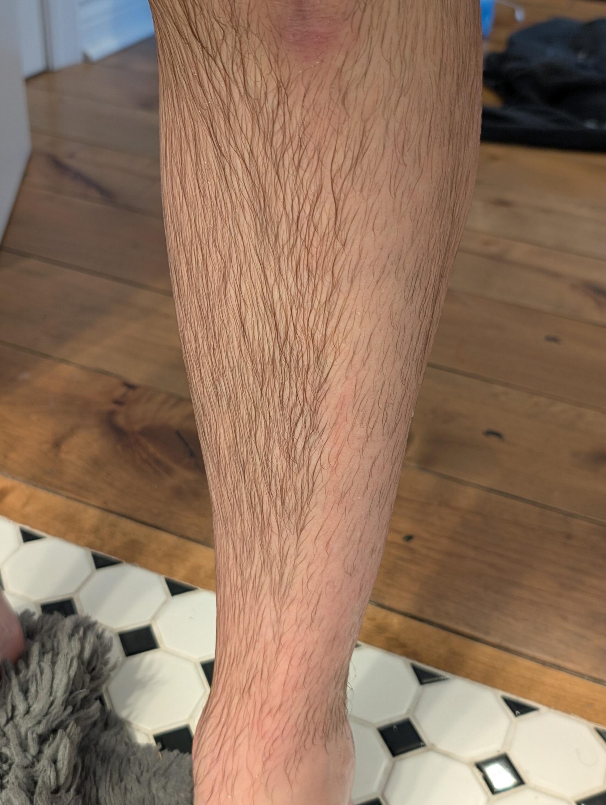 The hair on the outside of my leg is thinning.